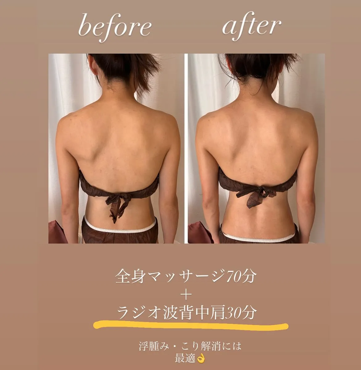 浮腫みと背中ケアで叶える健康美リラクゼーションの秘訣